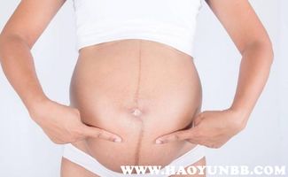 孕期怎样防止妊娠纹的出现呢