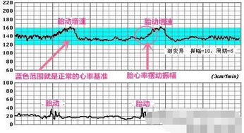 宫缩做胎监可以看出来吗多少周