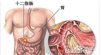 孕妇食物过敏下消化道出血吃什么药