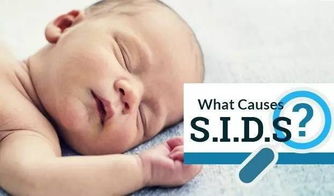 婴儿猝死综合征(SIDS)