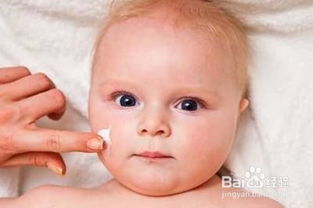 婴儿如何预防湿疹