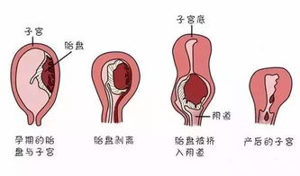 产后伤口观察的关键指标是