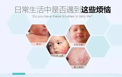 预防婴儿沐浴时的皮肤问题是