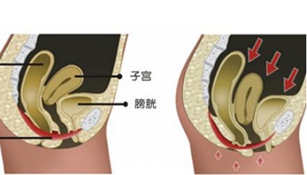 产后体质的变化