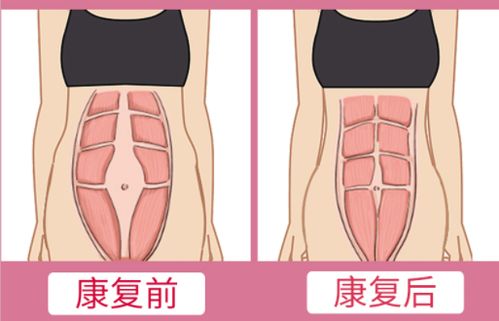 产后恢复的过程是怎样的