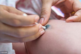新生儿脐带护理的要点包括哪些