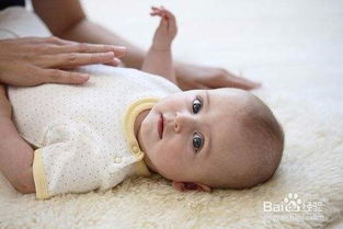 新生儿黄疸的预防与护理的目的是