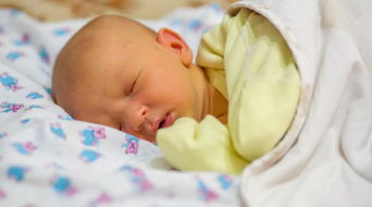 新生儿黄疸的预防和护理