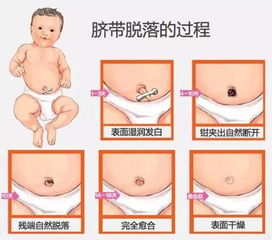 新生婴儿脐带护理的方法