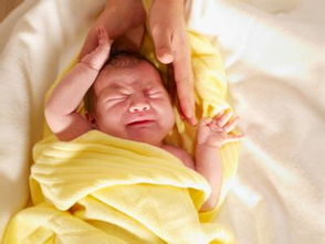 新生儿黄疸的表现和护理，如何预防?