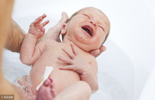 新生儿脐带护理应选什么