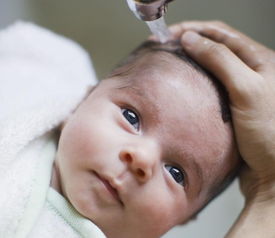 怎么预防新生儿脸上长湿疹呢