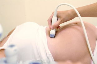 孕期高危因素监测