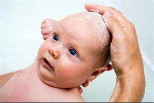 新生婴儿有头皮拿什么来洗掉